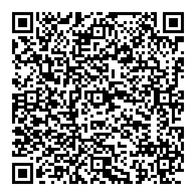 2014 포드 피에스타 1.6 에코부스트, 타이밍 틀림 파형분석