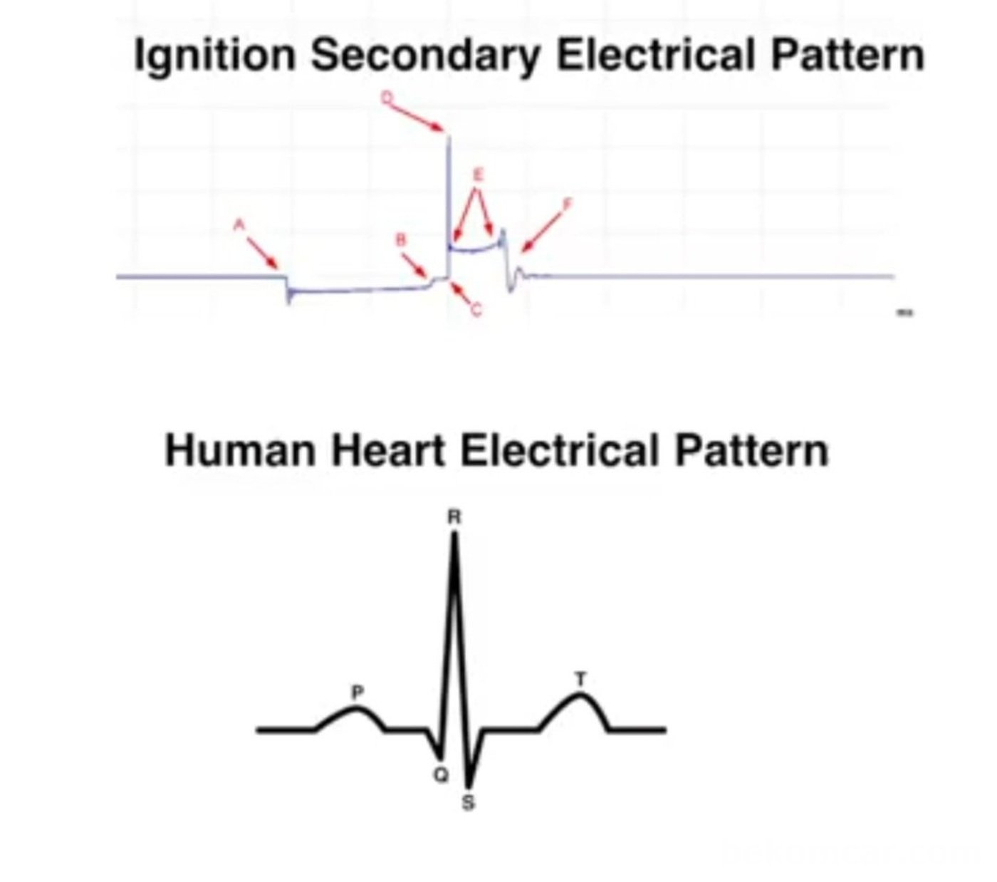 사람심장의 EKG 파형과 차량의 이그니션 파형의 ㅂ교모습이다. Courtesy of DeadOnDiagnostics|بيكومكار (bekomcar)